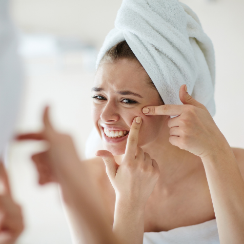 Acne 101 - Simple Treatments for Acne Prevention